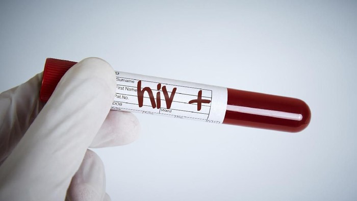 Peningkatan Kasus HIV di Indonesia: Prediksi 564 Ribu Pengidap pada 2025