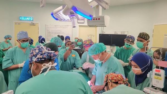 **Momen Dokter di Malaysia Sukses Operasi Bayi Kembar Siam Langka, Prosesnya 13 Jam**