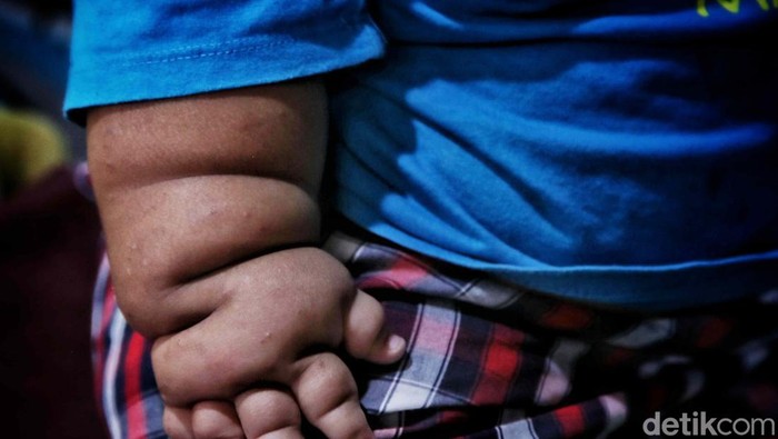 Jadi 'Biang Kerok' Obesitas-Diabetes, Makanan Ini Paling Banyak Dikonsumsi Warga Indonesia