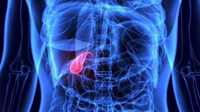 **Benarkah Batu Empedu Bisa Picu Kanker Saluran Empedu? Ini Kata Dokter Onkologi**