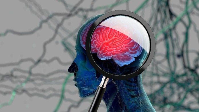 Mendadak Jadi Pelupa? Begini Membedakan Otak Lemot karena Umur dan Demensia