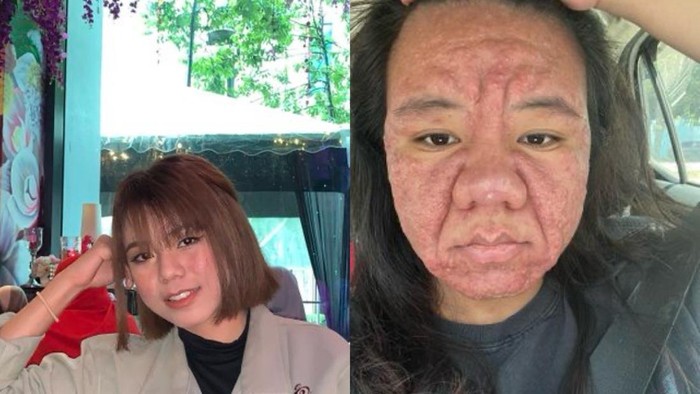 **Viral Ibu Curhat Wajah Berubah Total saat Hamil, Butuh Berapa Lama untuk Kembali?**