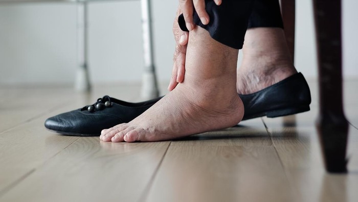 Tanda-Tanda Punya Masalah Jantung-Liver yang Bisa Terlihat di Kaki: Kenali Gejalanya Sejak Dini