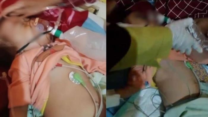 Viral Cacing Keluar dari Mulut-Hidung Balita Bengkulu: Fakta dan Pencegahan