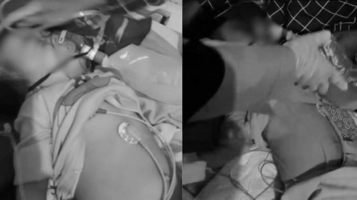 Kondisi Balita di Bengkulu yang Muntah Cacing dari Mulut-Hidung: Perhatikan Pencegahan Cacingan pada Anak